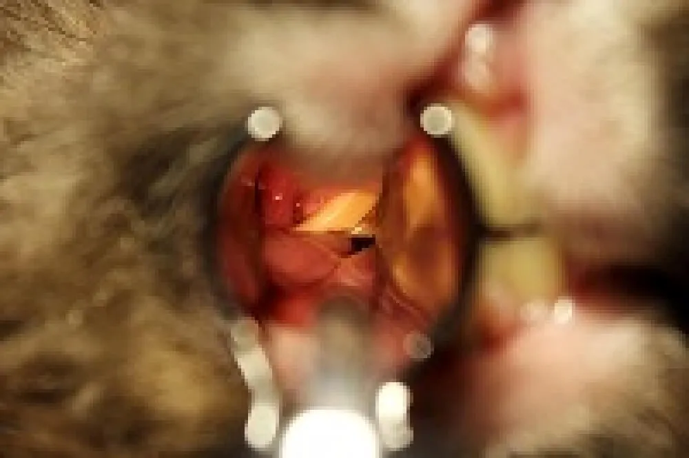 ■臼歯の不正咬合