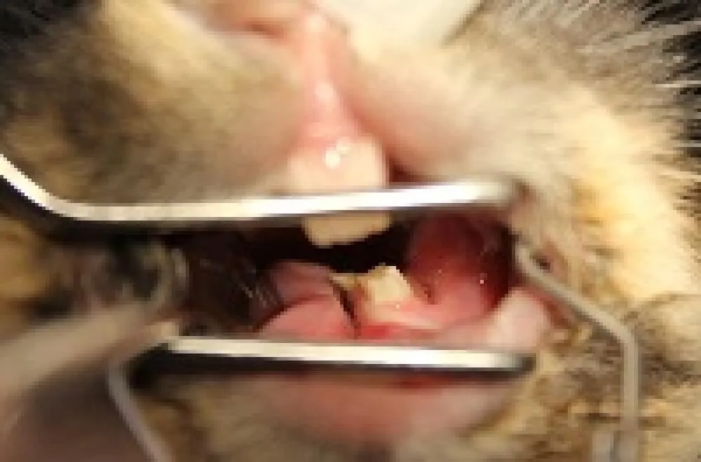 ■臼歯の不正咬合