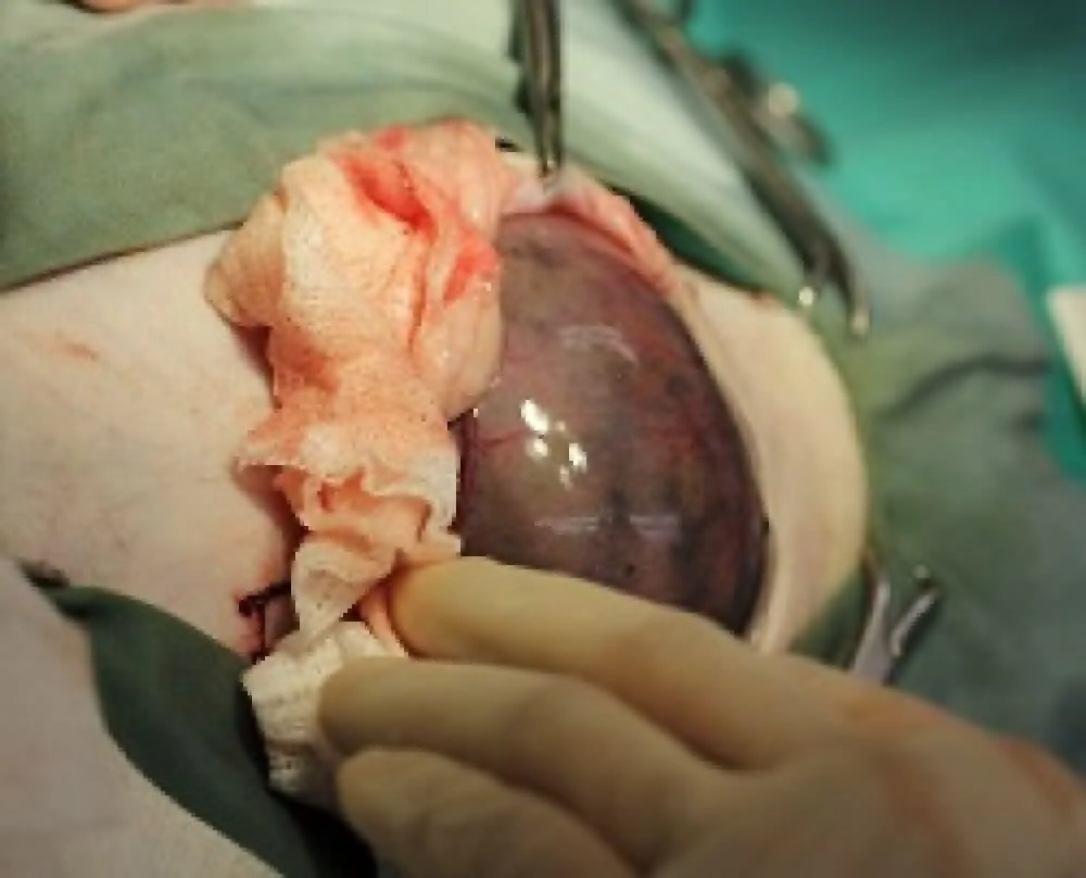 ■胃拡張の手術