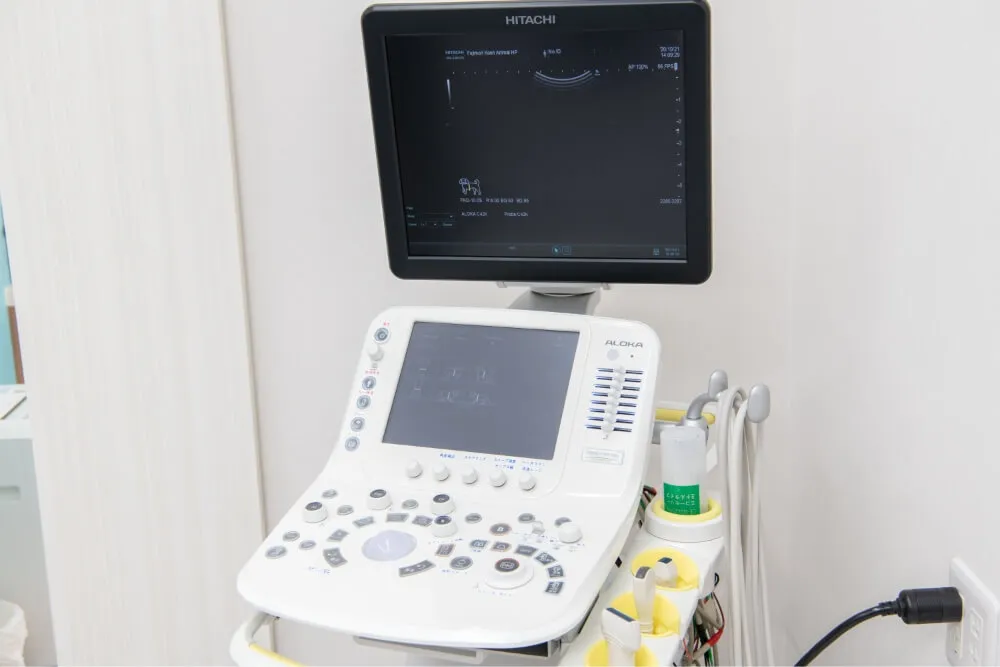 超音波診断装置